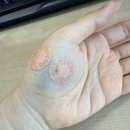 손목·팔까지 욱신거리는 통증, 부평 서울근본통내과 내돈내산 후기