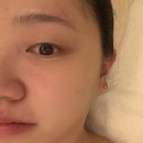 동탄 반송동 피부관리샵 추천 루스파 후기 맞춤 케어로 달라진 피부 컨디션