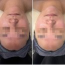 원영크레온 | 안산 웨딩관리 아로벨뷰티 유기윤곽관리로 리프팅관리 후기