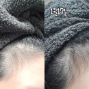 릴리약국 | 산후탈모 고민으로 시작한 릴리이브 그로우턴 앰플, 중간점검 후기