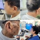 와이덱스 보청기 울산 남구점 | 울산포낙보청기 청각장애 지원 제도 안내 및 지원