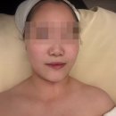 평택-안중-안중-13 | [평택/안중] 톤업 LDM 케어 피부관리 후기 - 리온즈에스테틱