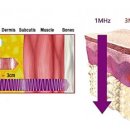 스키노바 이미지