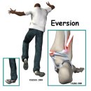 발목 염좌(Ankle Sprains) Ⅱ 이미지