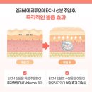 오라쁘띠의원 | 청주리투오, 효과 차이 제품 때문만은 아닙니다