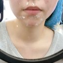 수북좋은약국 | 여드름 약국템+크림 조합으로 2주만에 꿀피부 만듬