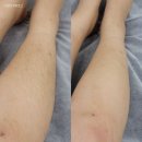 수유왁싱 JM뷰티 다리 슈가링왁싱 후기