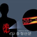 [이건 몰랐지] 약 없이 콜레스테롤 낮출 수 있다고? 이미지