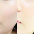 (주)에르쯔틴 이미지