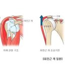 왼쪽 오른쪽 어깨 통증 원인 예방법 이미지