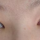 린 아이래쉬 이미지