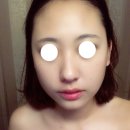 해와달 피부관리실 | 대구피부관리 수성구피부관리 "올가휴 해와달"
