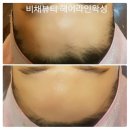 비채라인
