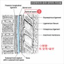 선정형외과의 어깨/팔/손끝까지 통증차단치료-경막외 차단술(epidural block) 이미지