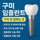 시온치과의원 | 구미시 치과 임플란트 잘하는곳 가격 비용 견적 (2025년 기준)