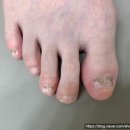 채이네일 이미지