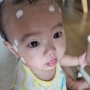 군산 프라자 약국 | 서수원 이마트 병원 메디모아의원 프라자 약국 후기 아기 뾰루지