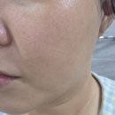 집에서 혼자 하는 리프팅 루틴 | 듀얼소닉 하이이피(HI-EP) 더블샷 솔직 후기