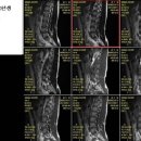 인터넷에서 MRI 사진 원없이 구경하네요.jpg 이미지