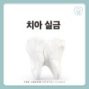 강창더좋은치과의원 | 치아 실금 방치하지 말고 계명대치과에서