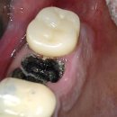 더드림치과기공소 이미지