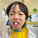 부평아트치과의원 | 발치 성공 🦷 울지 않고 씩씩했던 하루｜부평구 삼산동 연세주니어치과 후기 + 롯데마트 피카츄 선물까지 💛