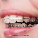 가지런한치과교정과치과의원 이미지