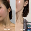 이지이샵 | 피부과 재생크림 추천 엘라스티 포스트랩 홈쥬란으로 시술 후 진정 케어