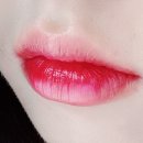 제스필의원 | ❤울산 입술필러후기! 당일~1일차❤