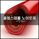 ◑ 콜레스테롤 노이로제 ◑ 이미지