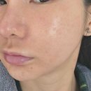 하이퍼메디컬 | <메디힐> 하이퍼 콜라겐 마스크 기획세트 솔직 후기 (feat. 무보정)