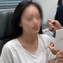 [대구 피부과] 턱 보톡스 맞으러 갔다가, 쓰리딥 리프팅과 슈링크까지 하고 온 리얼 후기