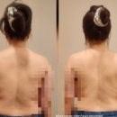 수원-1400 | 영통피부관리 선에스테스파 수원점 바디관리후기