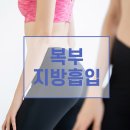 멍메이드 | 배지방흡입 후기 멍은 2주면 빠져요