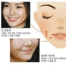 보조개 이미지