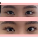 아이오니 뷰티(IONI BEAUTY) 네이버블로그