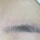 브라운아이의원 | [강남 눈썹문신제거] 내돈내산 실제 후기 강남 전 수아미 (현 브라운아이)