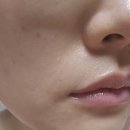 로지엘 리플러스 세럼으로 피부장벽케어, 약 2주간 사용후기