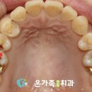 수연합치과기공소 네이버블로그