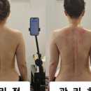 약속테라피 네이버블로그