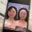 고온 | 운정피부관리 고온에스테틱 3V윤곽테라피 솔직 후기