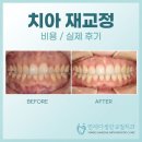 서울나란이치과교정과치과의원 | 치아 재교정 비용 및 실제 후기로 알아보는 재교정치과 선택 팁