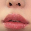 원더풀성형외과의원 | 원더풀 성형외과 눈 재상담 후기