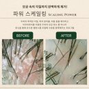 두피온