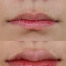 누브의원 이미지