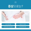 허&리신경외과 네이버블로그