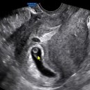 염정인여성의원 이미지