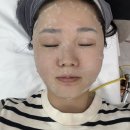 면목동-015 | 중랑구 환절기 피부관리 방법 사가정 브로우니옥 고주파 리프팅 관리 후기