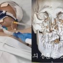 미혼 만 37세 여성까지 징집하는 병역법 개정안 의결 논의 완료 이미지