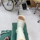 퍼스트 복지용구 | 발등 바사삭 .. 부제는 중족골 골절